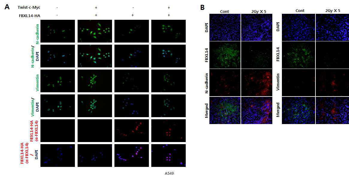 방사선 유도 FBXL14 E3 Ligase에 의한 Twist 단백질의 안정화