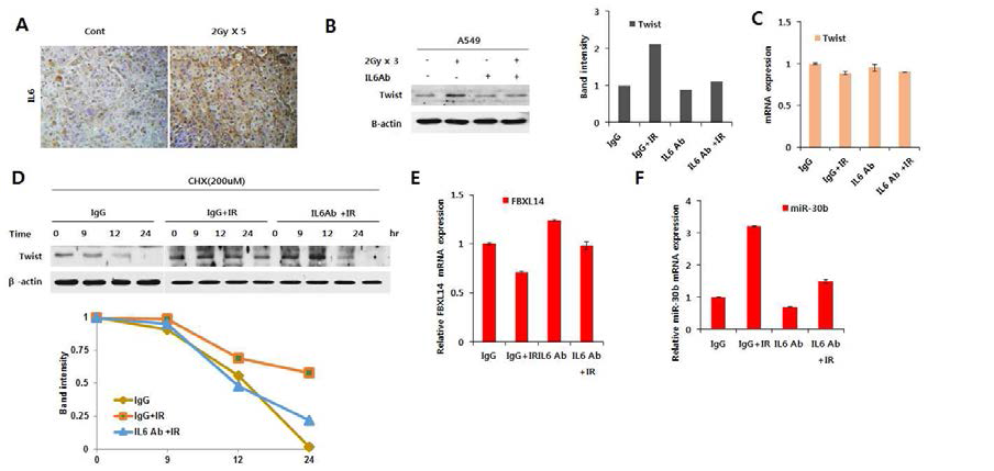 분할방사선 유도 분비인자 IL6에 의한 Twist 단백질 안정화에 따른 폐암세포의 EMT