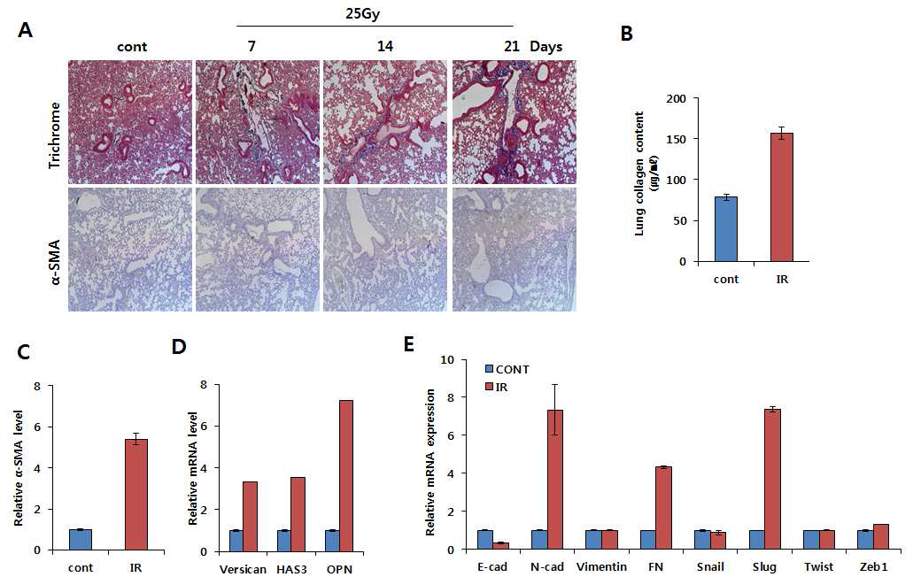 방사선조사 후 마우스 폐조직의 근섬유아세포 마커 α-SMA 염색
