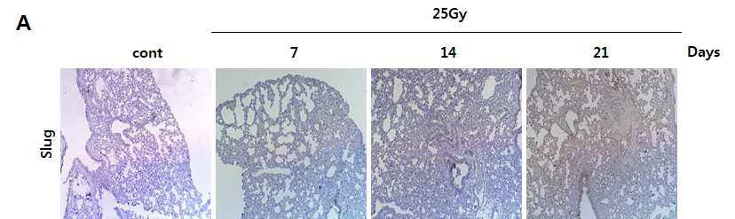정상 폐조직에서 방사선에 의한 EMT 전사인자 Slug 발현증가