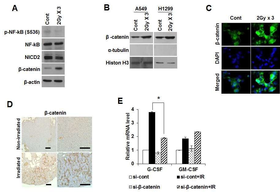 분할방사선 유도 β-catenin에 의한 폐암세포의 상피성-중배엽성 세포전이