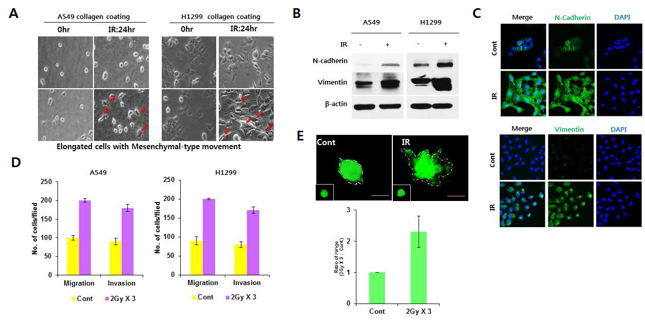 분할방사선에 의한 폐암세포 A549에서 EMT 기전에 의한 이동성, 침투성 획득