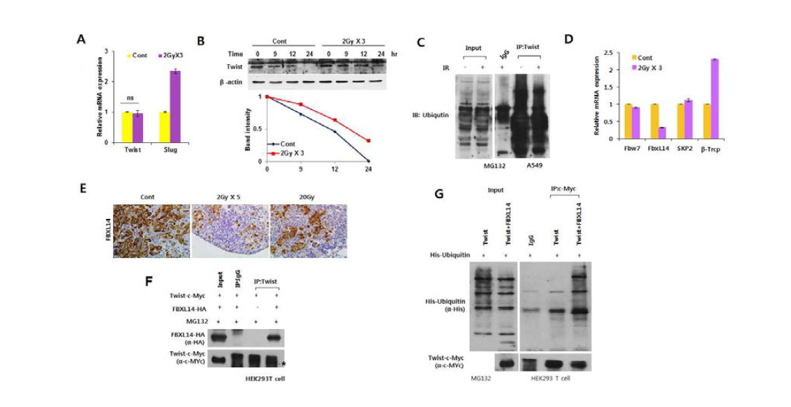 방사선 유도 FBXL14 E3 Ligase에 의한 Twist 단백질의 안정화