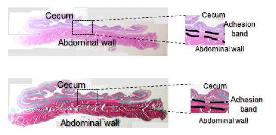 Histological observation of the abdominal wall treated with no anti-adhesion barrier in 28 days after surgery.