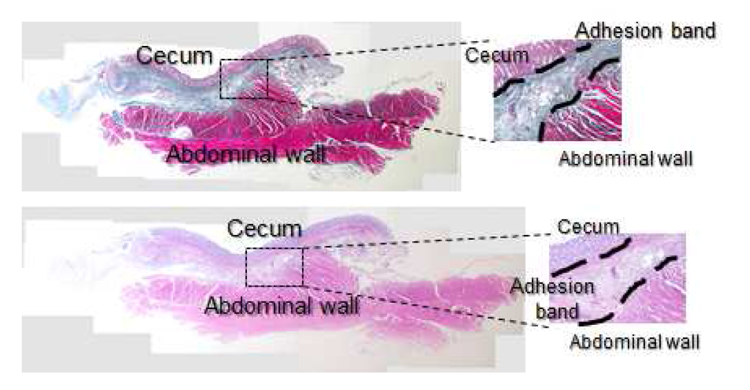 Histological observation of the abdominal wall treated with water vapor treated 80% SF film at 200kGy in 28 days after surgery.