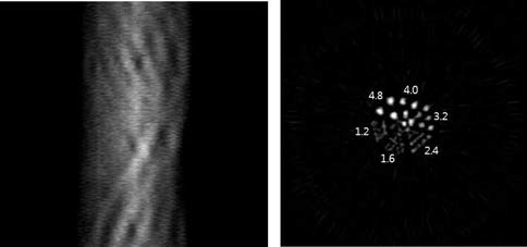 모터 및 제어프로그램으로부터 획득한 데이터를 이용하여 얻은 핫 로드 모형 사이노그램(좌). 개발된 여과후역투사 알고리즘으로 재구성된 핫 로드 모형 영상(우)