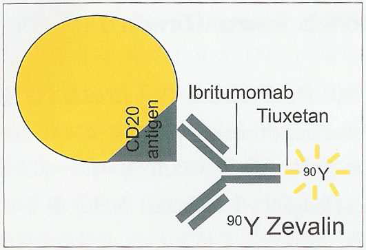 CD20 항원을 표적하는 제발린 (Zevalin) 모식도