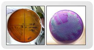 리그닌 단독 탄소원(좌) 및 Azure B를 이용한 리그닌 분해 활성 후보 박테리아의 분리