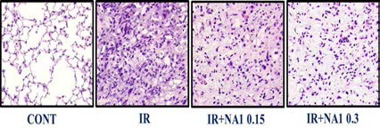 방사선 75 Gy 조사후 HSP27 저해제 선도물질 NA1의 용량별(0.15, 0.3 mg) 폐조직의 H&E staining.