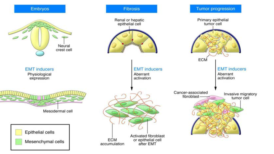 Fibrosis에서 EMT 현상 모식도