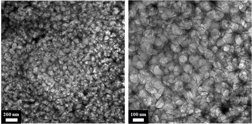 TEM image of the activated carbons from cellulose
