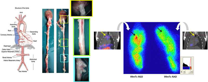 대동맥 적출 및 검안 그리고 autoradiography 평가