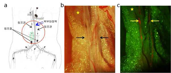 자성형광 나노입자를 이용한 림프관 내 미세 구조물의 형광 영상화 (a: 모식도, b: 해부학적 칼라영상, c: 형광 영상)