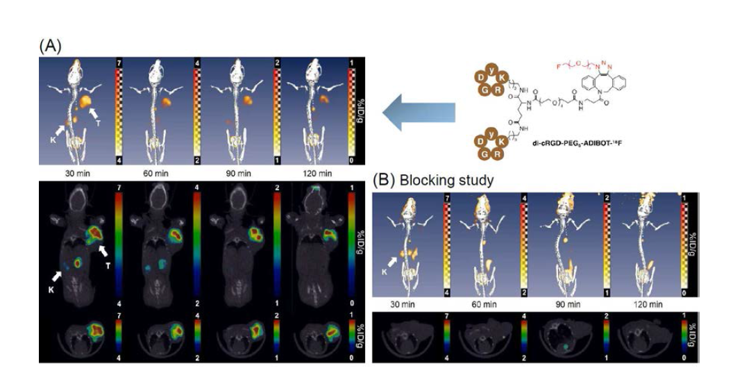 A) In vivo evaluation of di-cRGD-PEG5-ADIBOT-18F; Three-dimensional (3D) reconstruction (upper), coronal (middle) and transverse section (lower) combined PET-CT images of the U87MG tumor bearing mice at 30, 60, 90, and 120 min postinjection of di-cRGD-PEG5-ADIBOT-18F (1.8MBq). (B) “Blocking” images with a coinjection of nonradioactive di-cRGD-PEG5-ADIBOT-F (10 mg/kg). T = tumor, K = kidney