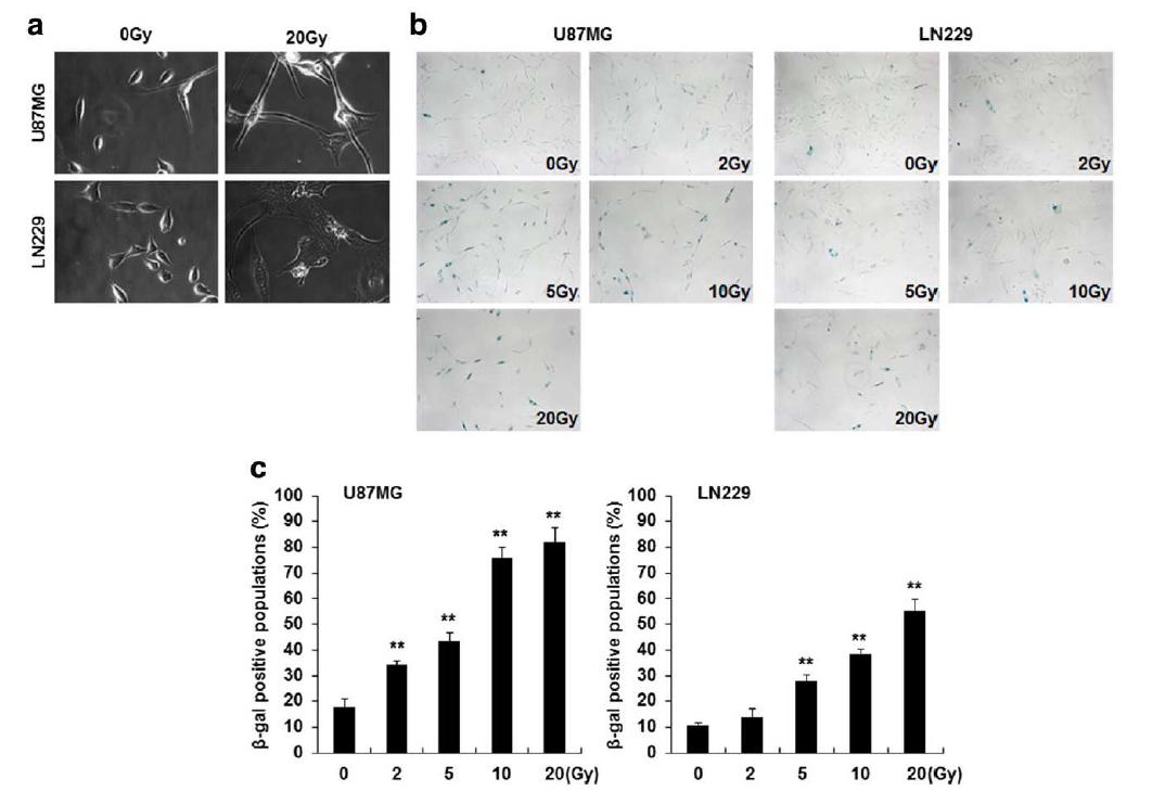 방사선 조사된 세포의 세포노화 검증
