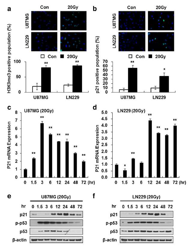 방사선 조사된 세포의 p53-p21 신호 기전 확인