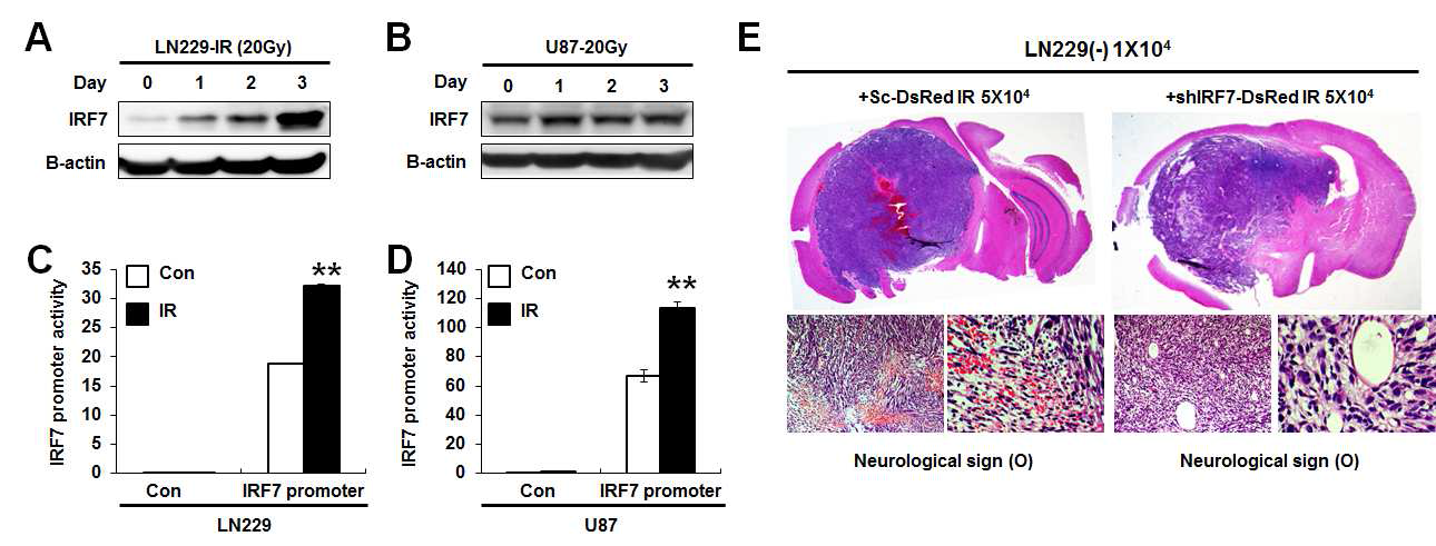 신경교종세포에 방사선 조사 후 증가하는 IRF7 발현 및 종양 형성능 비교