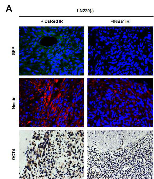 In vivo에서 NFκB 신호 억제를 통한 암 미세환경의 변화와 신경교종 줄기세포로의 전변 능력 검증