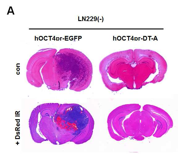 LN229-phOCT4pr-DT-a 세포주의 암 형성 능력 확인