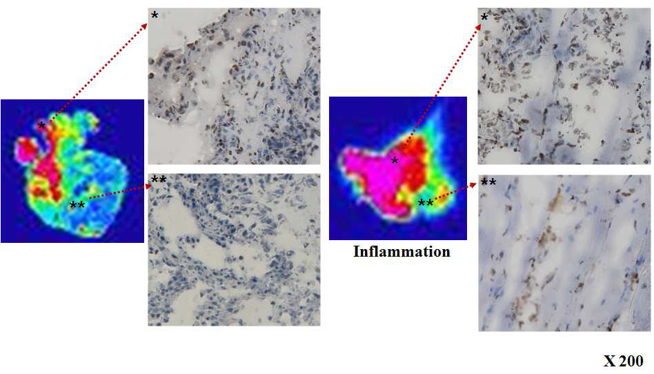 [종양 조직과 염증조직의 89Zr-oxalate의 Autoradiography 와 Histology]