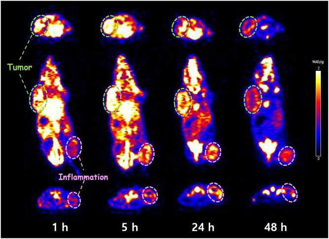[종양과 염증을 가진 마우스에서 89Zr-oxalate의 microPET 영상]