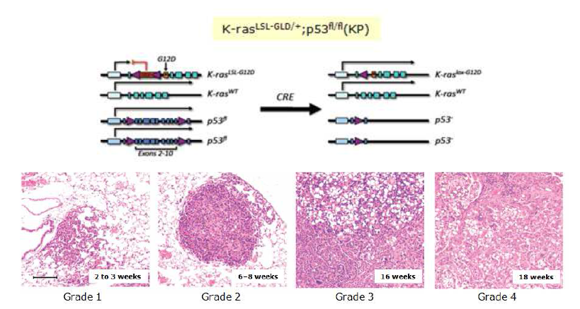 Oncogenic K-ras의 활성화와 p53의 조건부돌연변이 모델 (LSL-K-rasG12D; p53R270H/Fl)을 이용한 human NSCLC를 mimic한 마우스모델