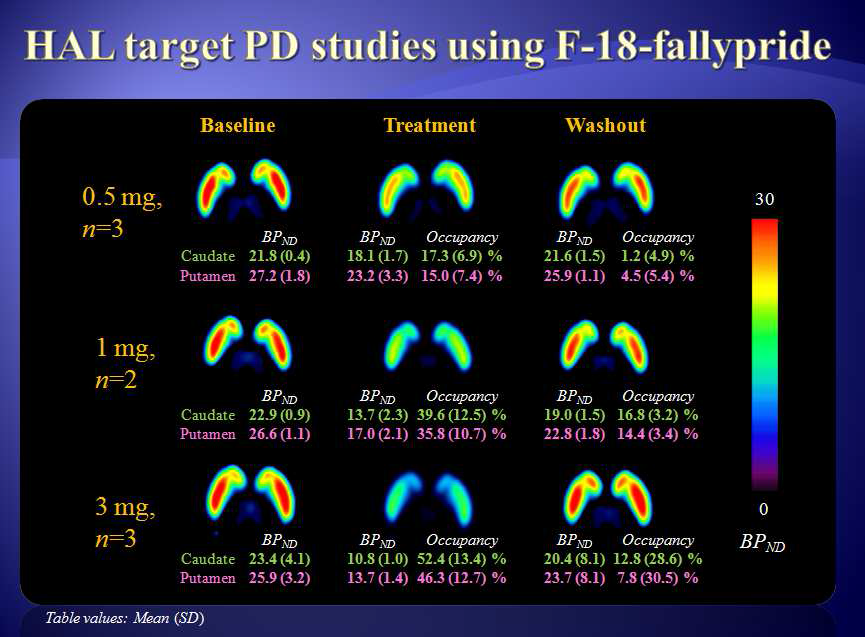 Haloperidol Brain PD studies using F-18 Fallypride