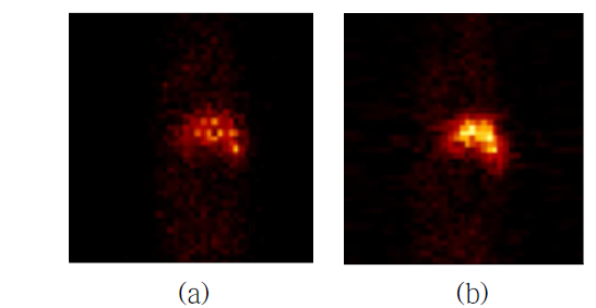NaI(Tl) 검출기 기반의 SPECT 시스템에서 mouse Liver의 프로젝션 (a), 재구성 영상 (b)