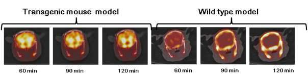 알츠하이머병 모델 형질전환 마우스(APP/PS1)와 wild type 마우스에서 SNUBH-NM-333 뇌 PET 영상