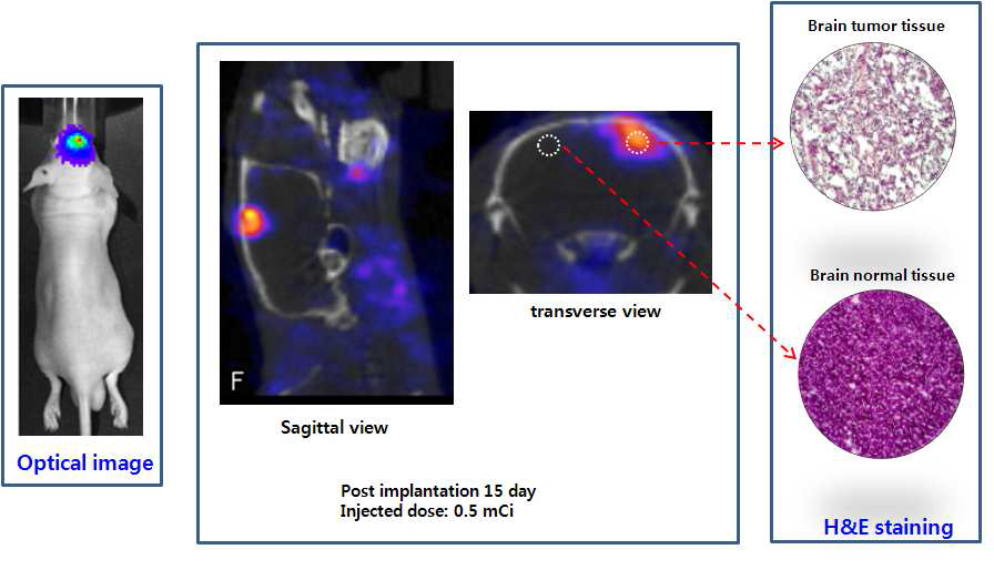 SNUBH-NM-505의 orthotopic brain tumor model에서의 SPECT 분자영상