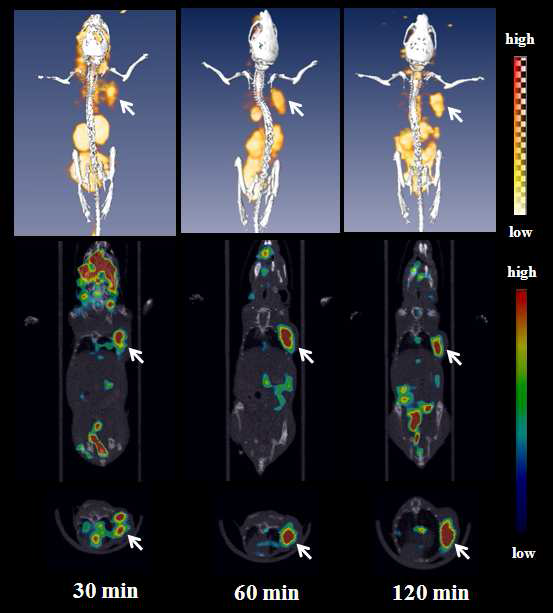 F-18 ApoPep-1 9를 이용한 PET/CT 이미지