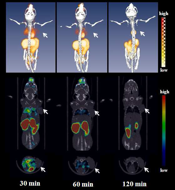 F-18 ApoPep-1 B type probe를 이용한 PET/CT 이미지