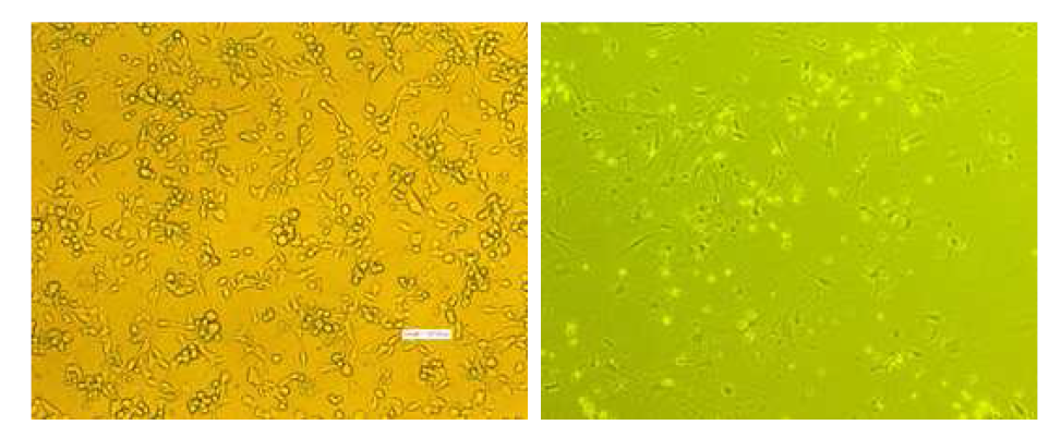 계대배양 시작 직후 종양 내 다양한 세포들이 집합 된 결과 (왼쪽)와 장기간에 걸친 계대 배양을 통해 종양세포만 특이적으로 배양 된 결과 (오른쪽)
