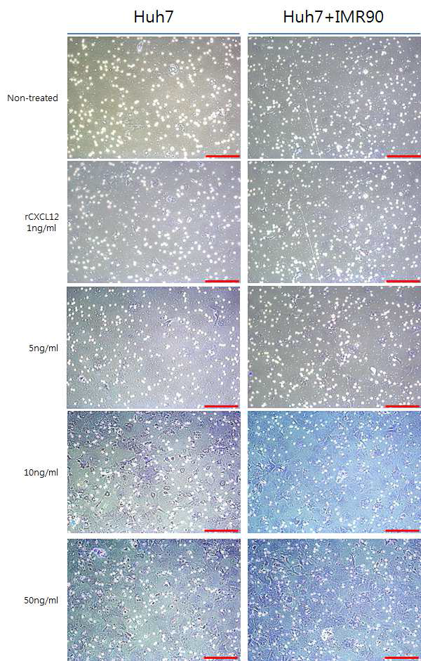 Recombinant CXCL12의 농도 의존적 Huh7의 침윤 정도 분석