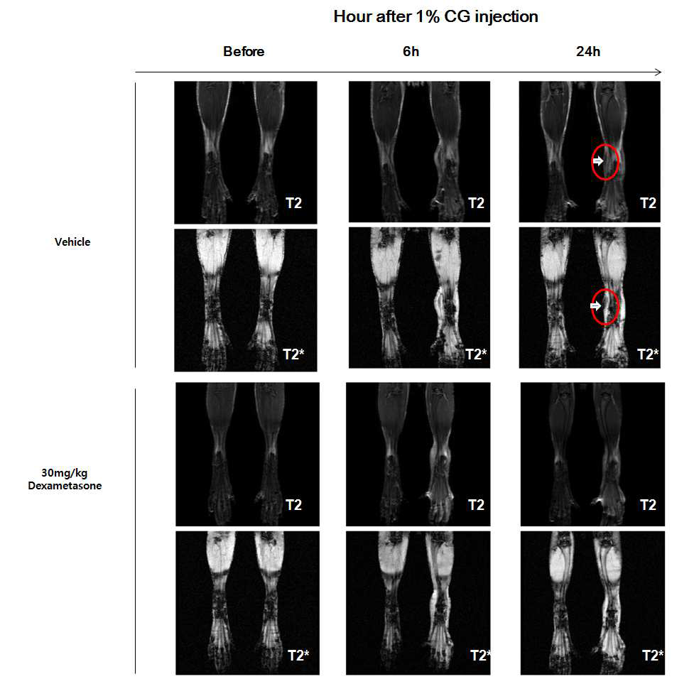 MR imaging of macrophage migration to CG-injected footpad