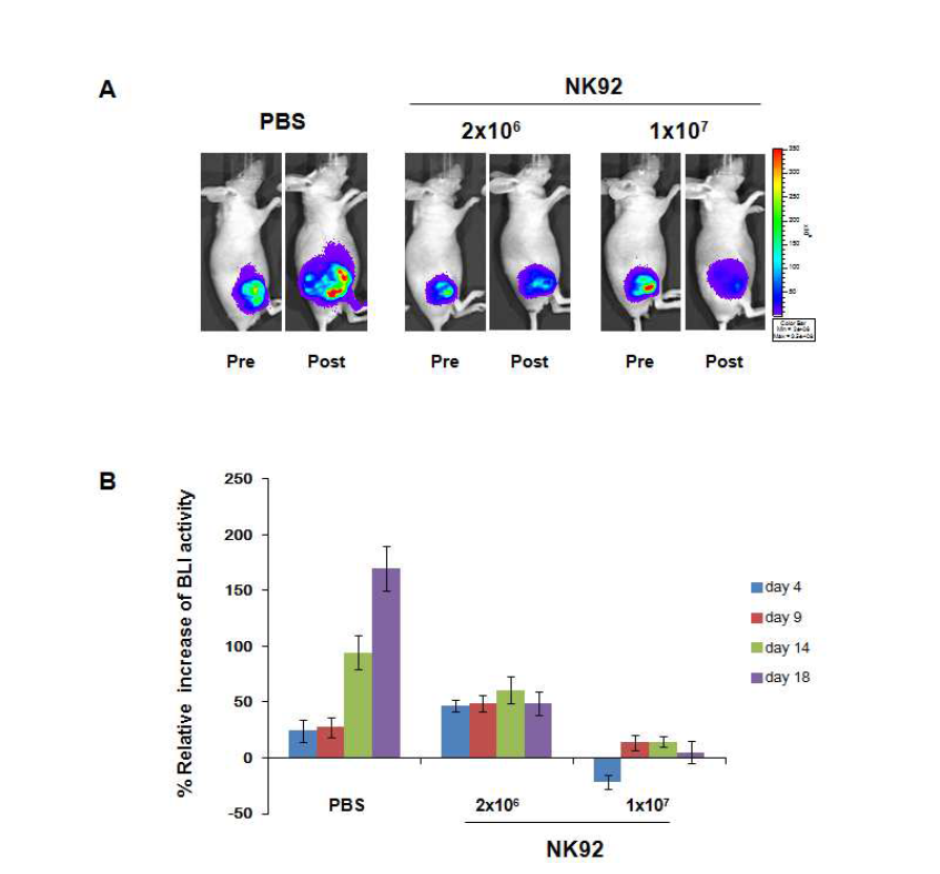 Imaging of anti-tumor effects by NK therapy