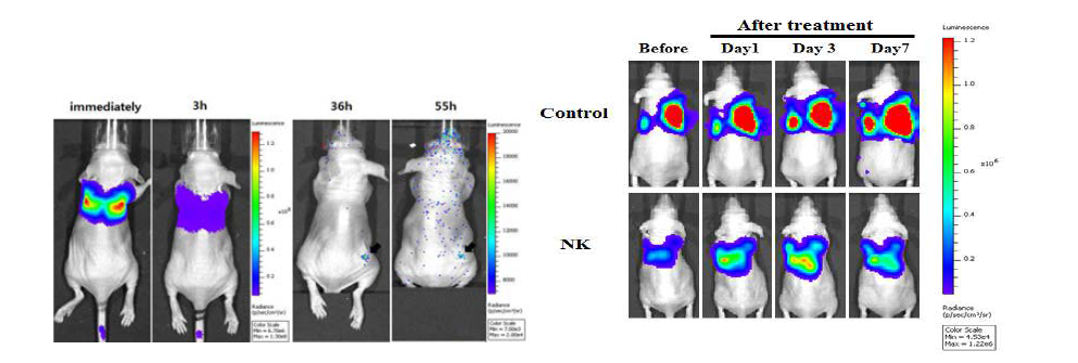 NK세포의 체내이동 영상화(left) 및 종양치료효능 모니터링(right)