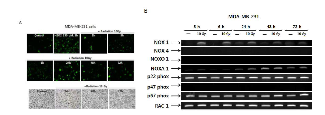 감마선으로 유도된 MDA-MB-2321 유방암 세포에 대한 ROS 생성 및 NADPH oxidase 요소 발현