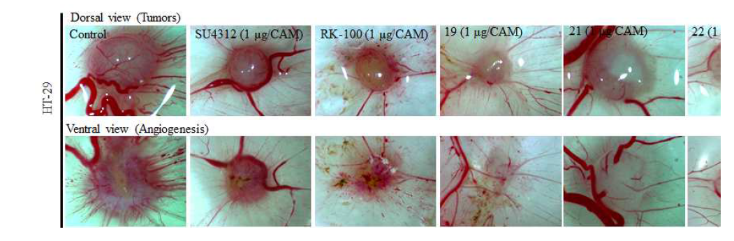 HT29 대장암 세포를 접종시킨 CAM 모델에서 SU4312 및 RK 화합물에 대한 혈관 생성 및 종양 성장 억제 효능