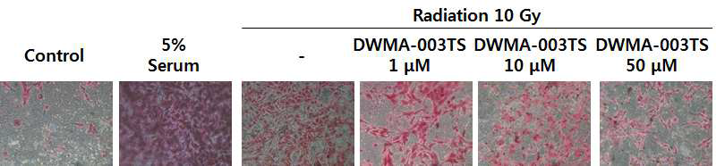 MDA-MB-231 세포 침윤에 대한 DWMA-003TS 및 감마선의 병용 효과