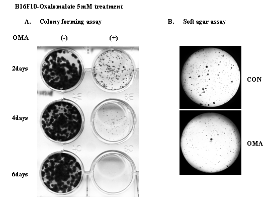 B16F10 흑색종세포에서 oxalomalate의 항종양 효과