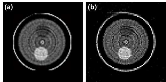광자계수기반 CZT 검출기를 사용하여 획득한 180개 투사영상을 재구성한 영상 (a) 필터링후 역투영기법과 Ram-Lak 필터를 사용하여 재구성한 단층영상 (b) 반복적재구성기법 (CS)을 사용하여 재구성한 단층영상
