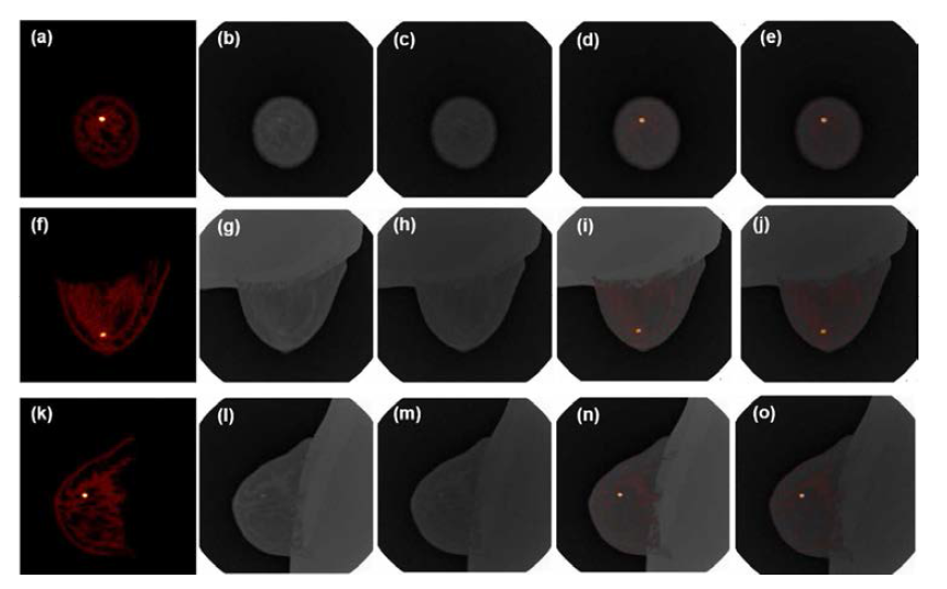 (a), (f), (k) SPECT 영상, (b), (g), (i) 낮은 에너지를 이용 한 Spectral-CT 영상, (c), (h), (m) 높은 에너지를 이용한 Spectral-CT 영상, (d), (i), (n) 낮은 에너지를 이용한 SPECT/Spectral-CT 융합영상, (e), (j), (o) 높은 에너지를 이용한 SPECT/Spectral-CT 융합영상