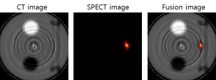 단일광자계수기반 검출기를 이용한 SPECT 및 CT 획득 영상 및 융 합영상