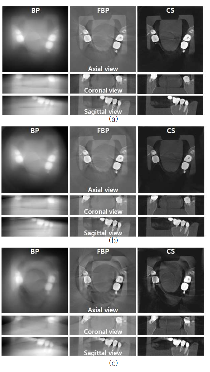 빔의 cone angle에 의해 FOV data가 부족한 경우 재구성한 결과 영상: target FOV가 X-ray field 내에 (a) 모두 포함되는 경우, (b) 모두 포함되 지 않는 경우(cone angle: 4.5o),(c)모두 포함되지 않는 경우(cone angle: 14.6o)