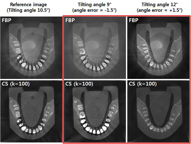 Detector-tilting angle error 발생 시의 재구성 영상 결과