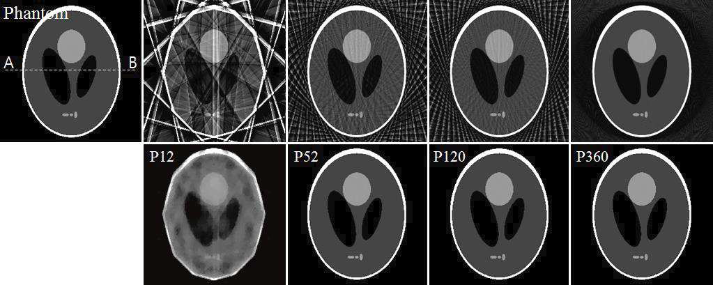 Sparse-view CBCT 스캔 구조일 때 재구성된 영상: Shepp-Logan 팬텀(12, 52, 120, 360 장), FBP(상), CS(하)