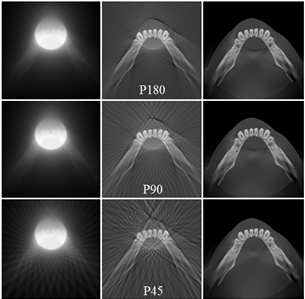 중간 크기의 ROI에 대해 projection 수(180장, 90장, 45장)에 따라 재구성한 CT 영상 결과: BP, FBP, CS