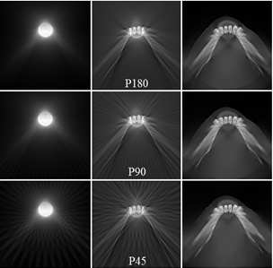 작은 크기의 ROI에 대해 projection 수(180장, 90장, 45장)에 따라 재구성한 CT 영상 결과: BP, FBP, CS