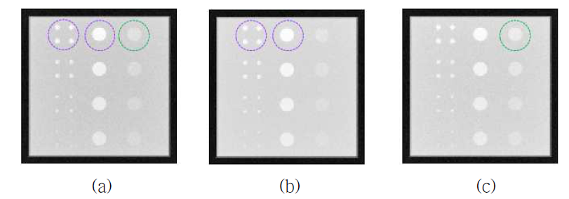 (a) reference 영상, (b) CaCO3 1.6 mm에 최적화된 영상, (c) Iodine 1.6 mm에 최적화된 영상